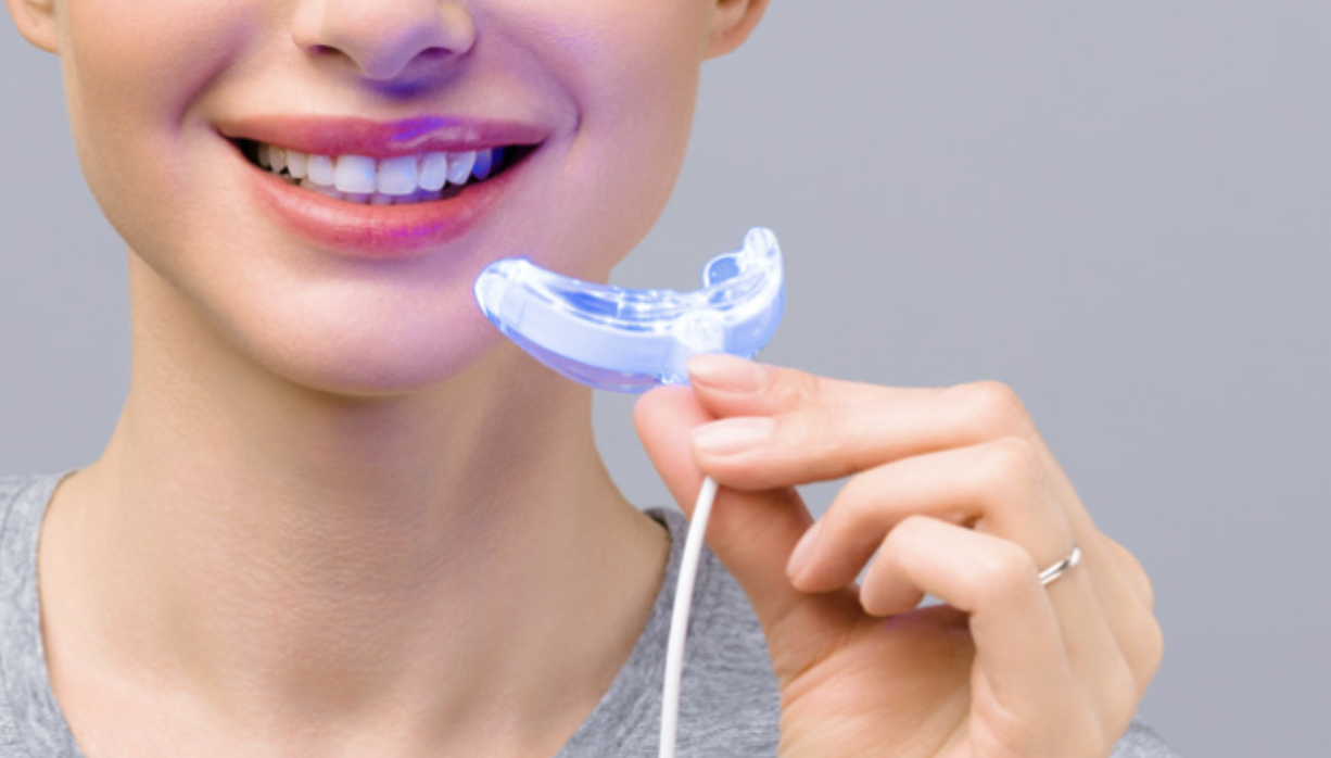 How Long Will Teeth Whitening Last?