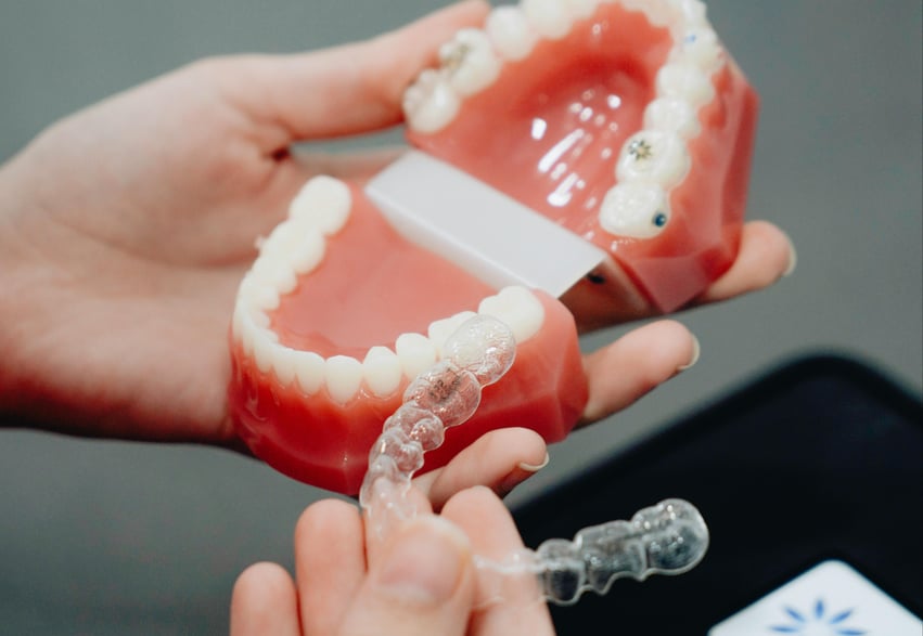 Invisalign desplay