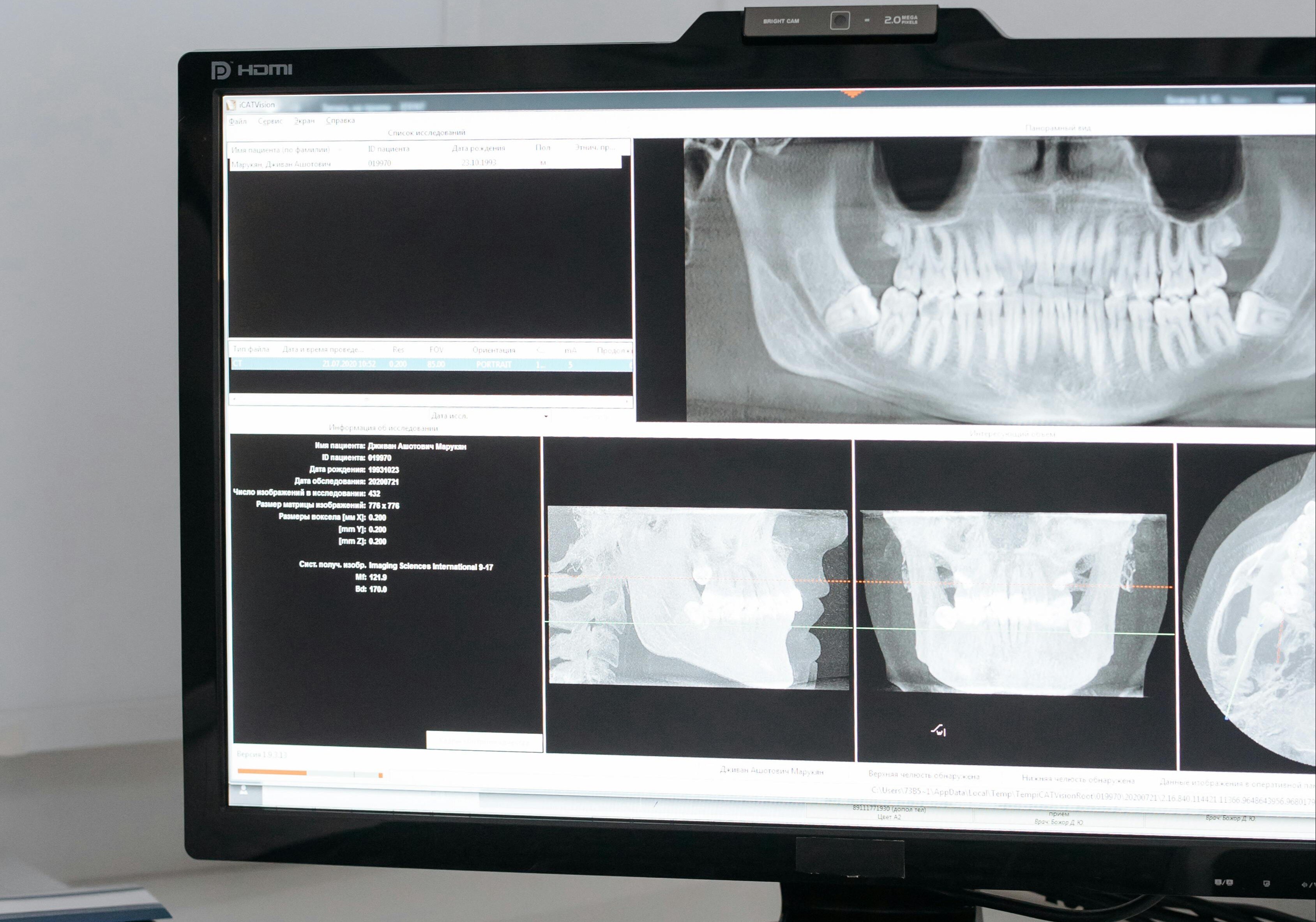 Dental record