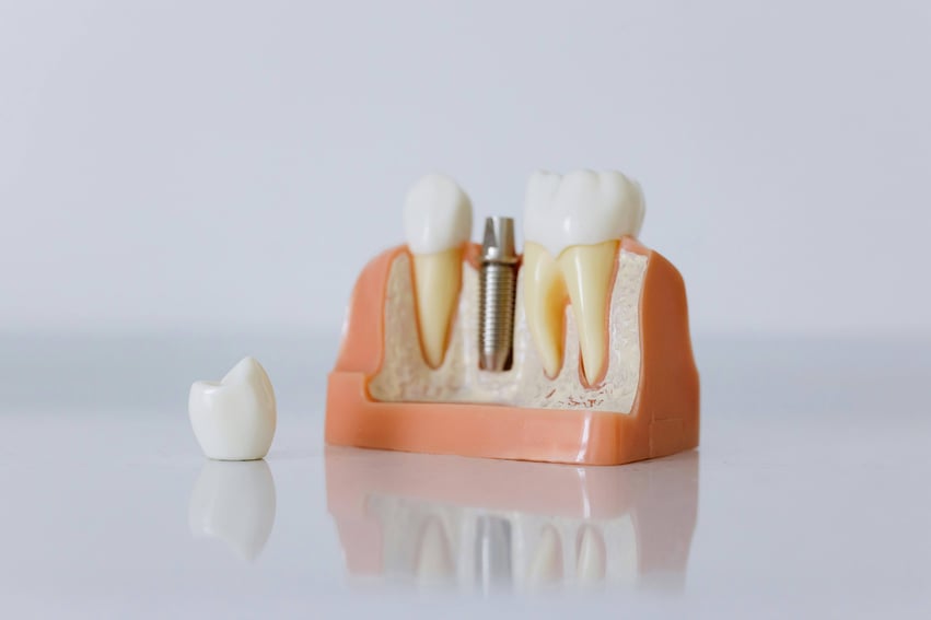 Tooth diagram