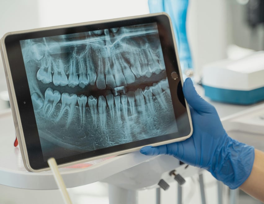 Dental x ray record