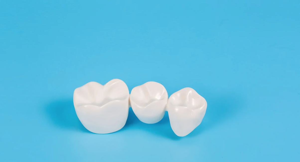 Dental Crowns