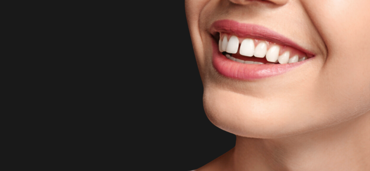 A person with gaps in their teeth