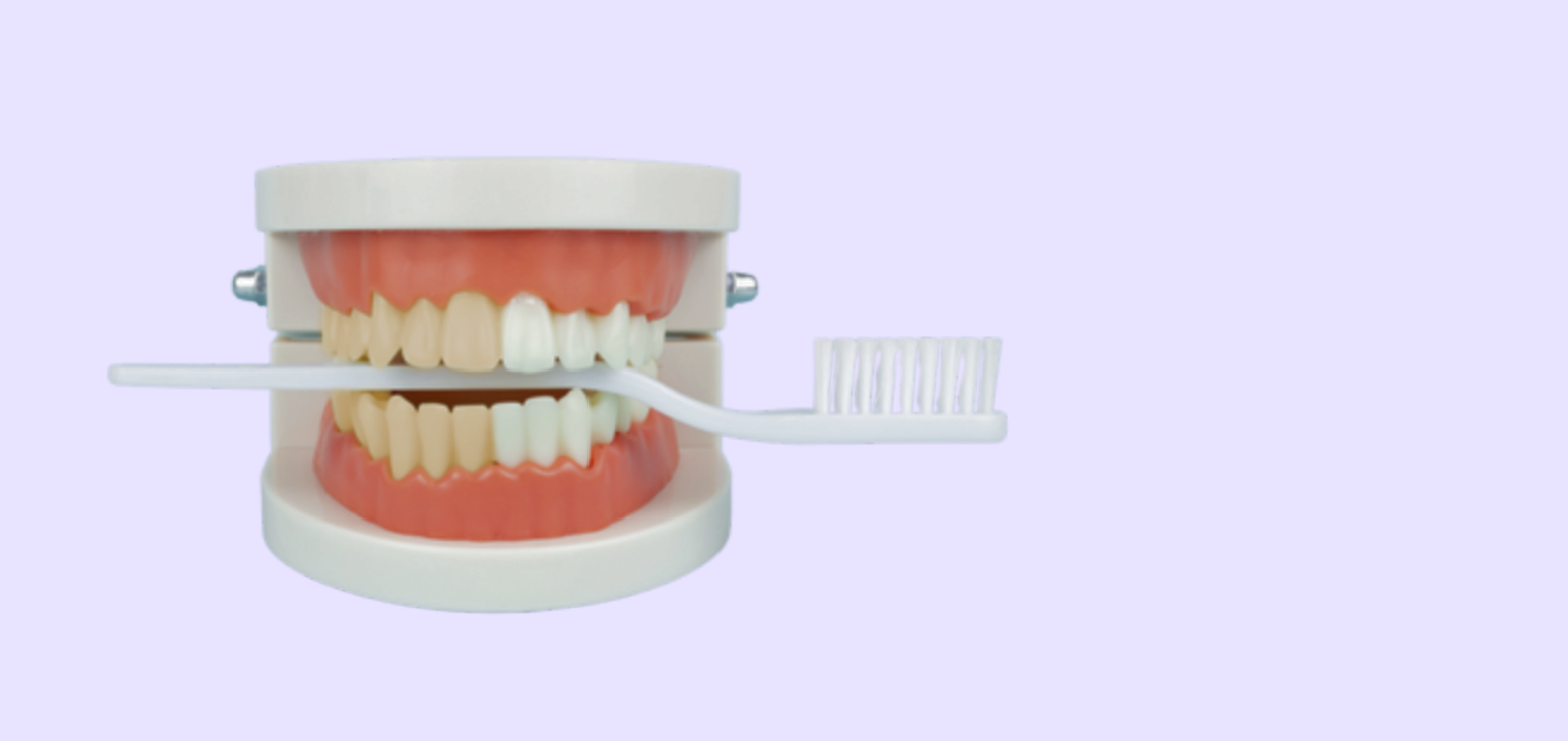 Tooth whitening diagram