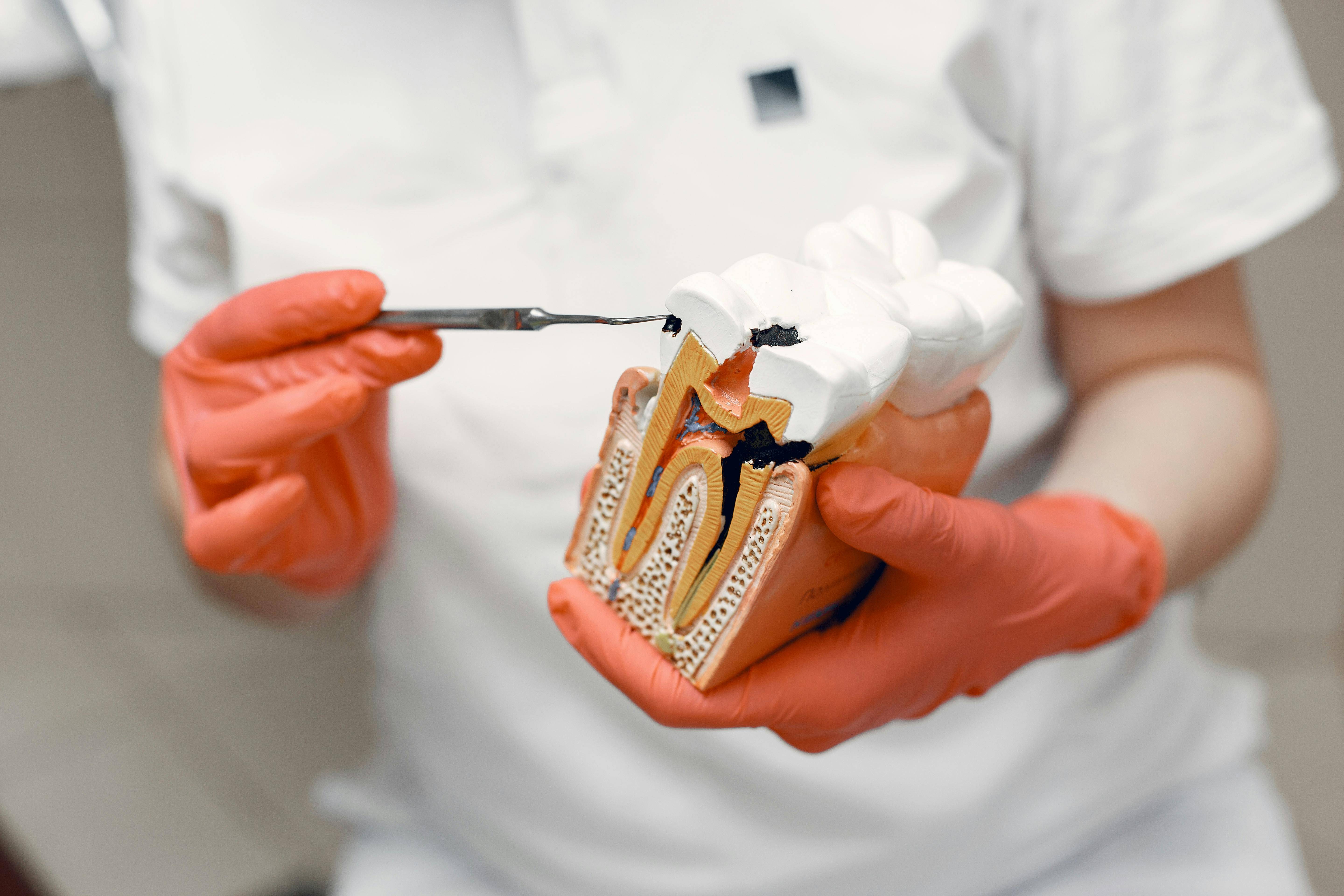 Tooth display with decay