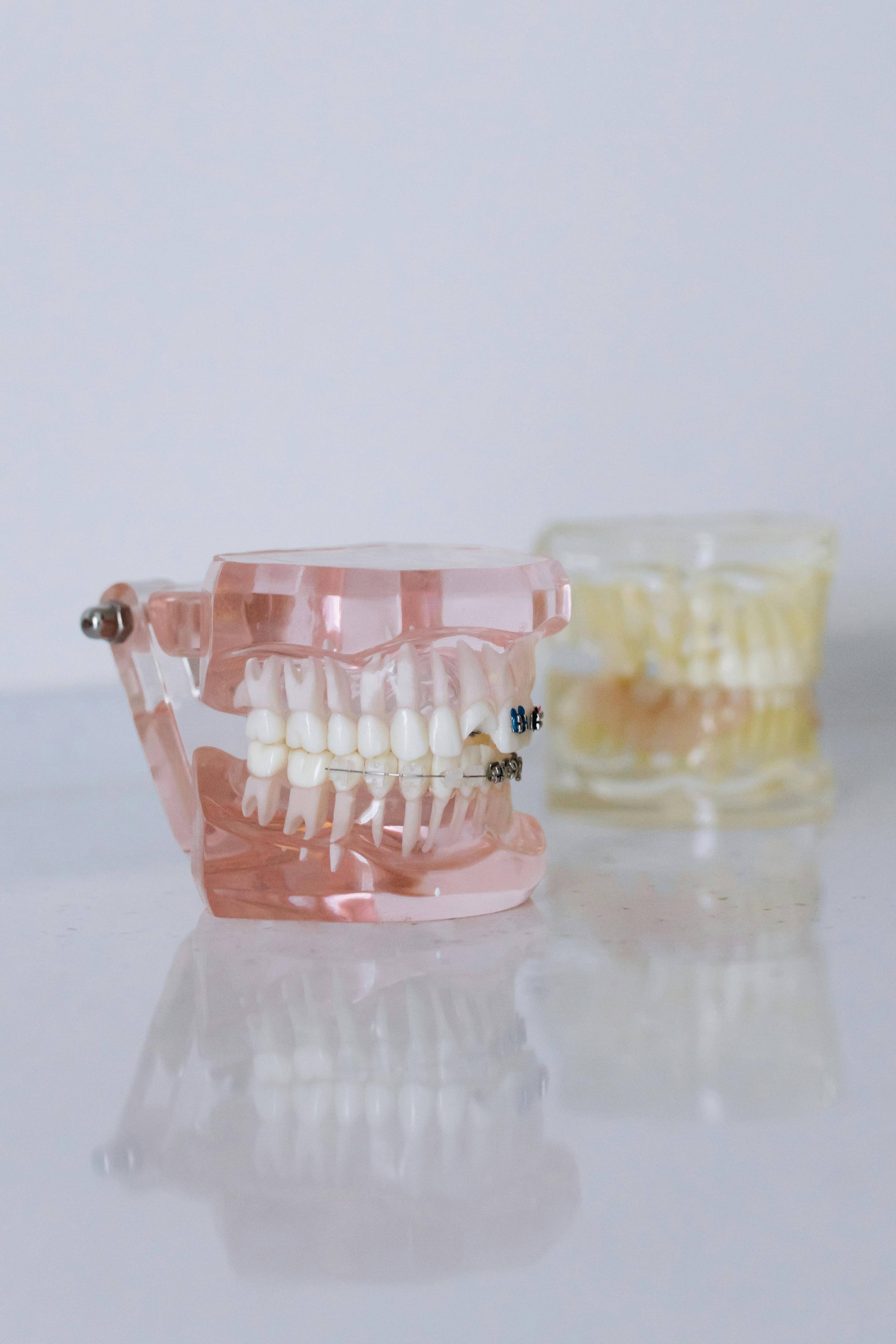 Dental crown display