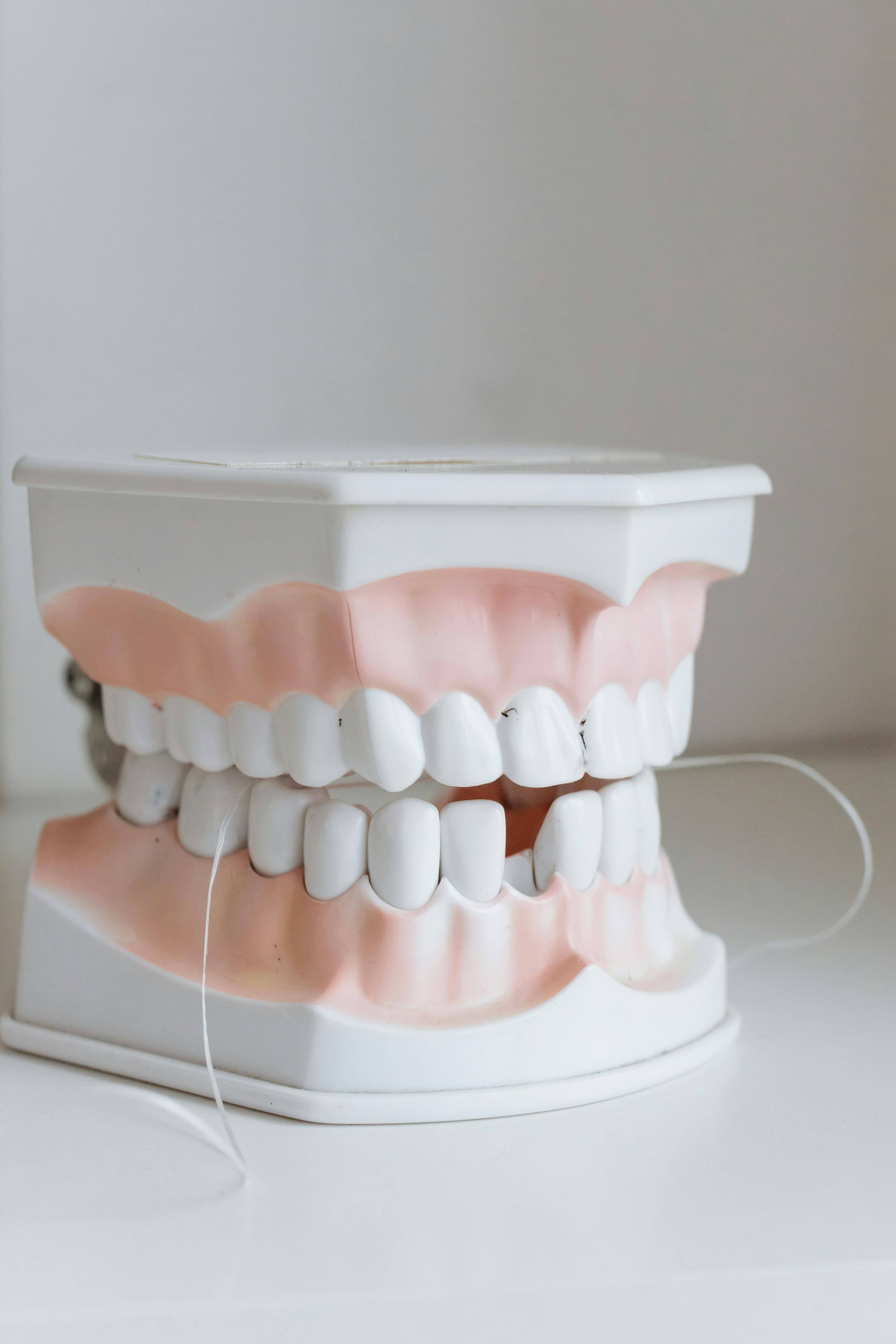 Tooth diagram